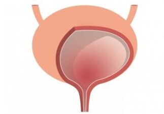 bladder and strengthening the capsules of female organs